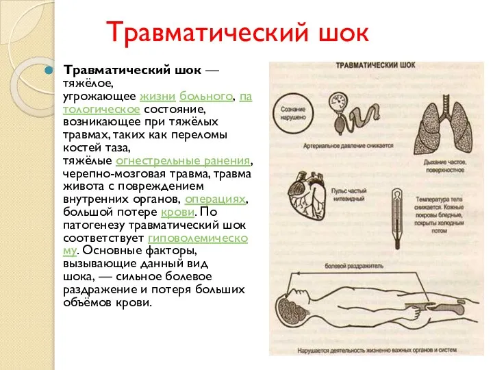 Травматический шок Травматический шок — тяжёлое, угрожающее жизни больного, патологическое состояние, возникающее