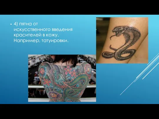 4) пятна от искусственного введения красителей в кожу. Например, татуировки.