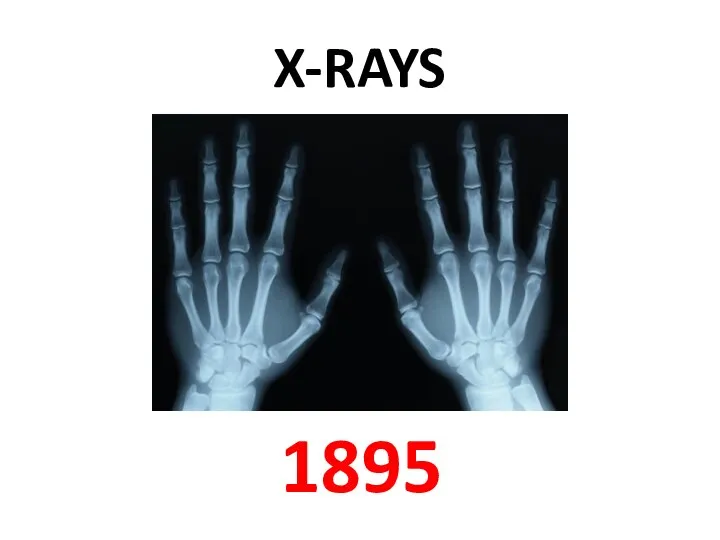 X-RAYS 1895