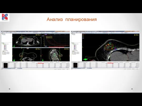 Анализ планирования