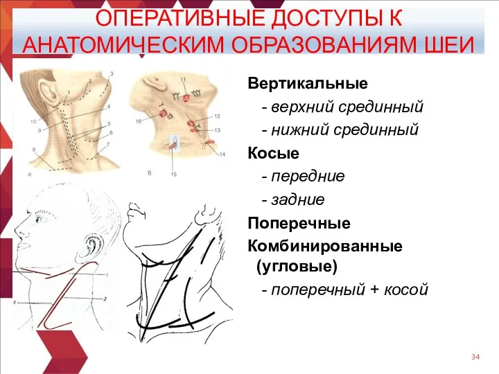 ОПЕРАТИВНЫЕ ДОСТУПЫ К АНАТОМИЧЕСКИМ ОБРАЗОВАНИЯМ ШЕИ Вертикальные - верхний срединный - нижний