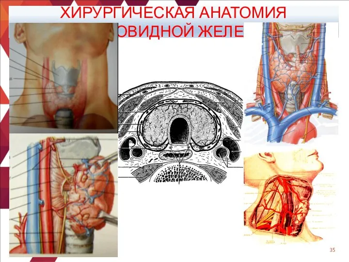 ХИРУРГИЧЕСКАЯ АНАТОМИЯ ЩИТОВИДНОЙ ЖЕЛЕЗЫ