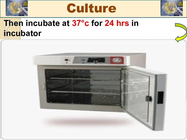 Then incubate at 37°c for 24 hrs in incubator Culture
