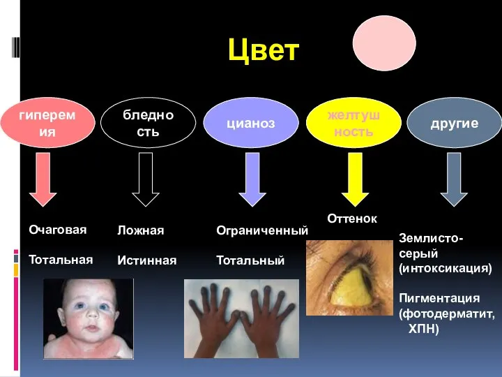 Цвет бледность цианоз желтушность другие гиперемия Очаговая Тотальная Ложная Истинная Ограниченный Тотальный