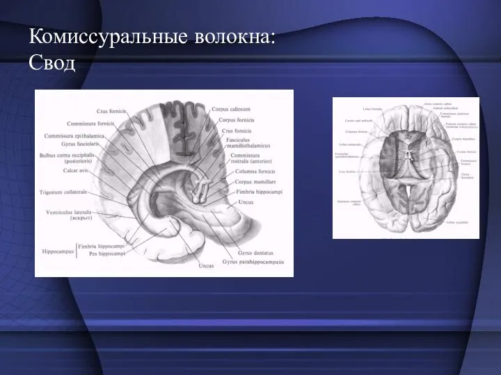 Комиссуральные волокна: Свод