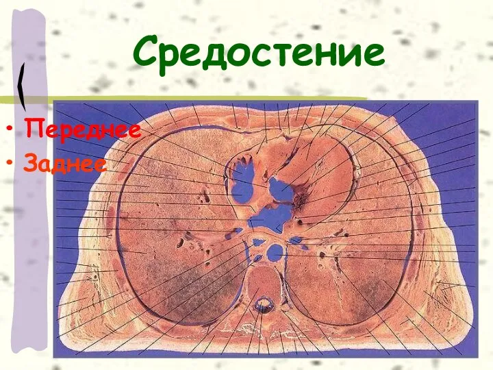 Средостение Переднее Заднее