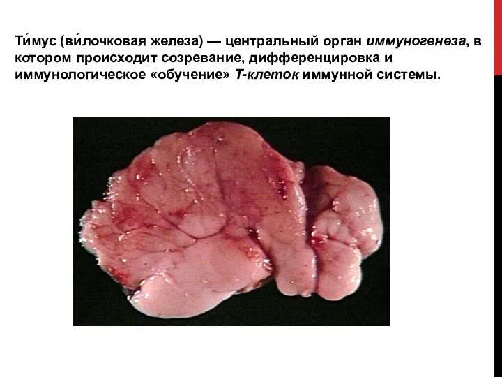 Ти́мус (ви́лочковая железа) — центральный орган иммуногенеза, в котором происходит созревание, дифференцировка
