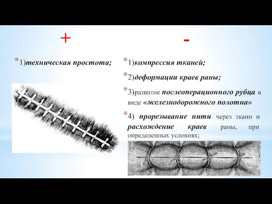 + 1)техническая простота; - 1)компрессия тканей; 2)деформации краев раны; 3)развитие послеоперационного рубца