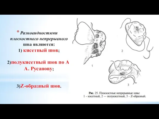 Разновидностями плоскостного непрерывного шва являются: 1) кисетный шов; 2)полукисетный шов по А. А. Русанову; 3)Z-образный шов.