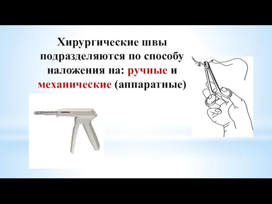 Хирургические швы подразделяются по способу наложения на: ручные и механические (аппаратные)