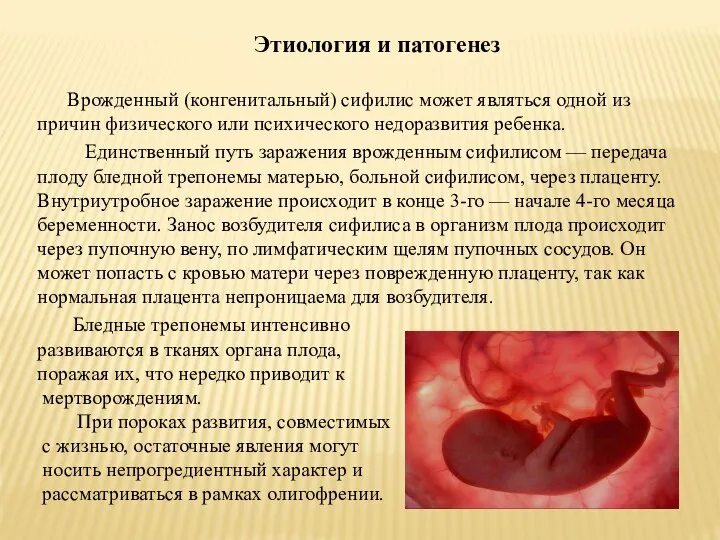 Этиология и патогенез Врожденный (конгенитальный) сифилис может являться одной из причин физического