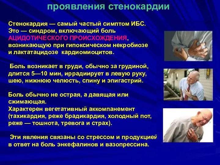 проявления стенокардии Стенокардия — самый частый симптом ИБС. Это — синдром, включающий