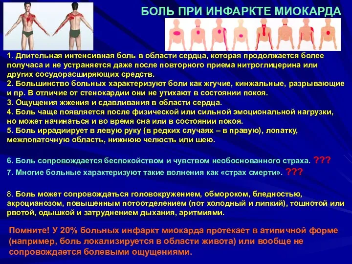 БОЛЬ ПРИ ИНФАРКТЕ МИОКАРДА Помните! У 20% больных инфаркт миокарда протекает в