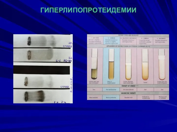 ГИПЕРЛИПОПРОТЕИДЕМИИ