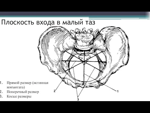 Плоскость входа в малый таз Прямой размер (истинная конъюгата) Поперечный размер Косые размеры