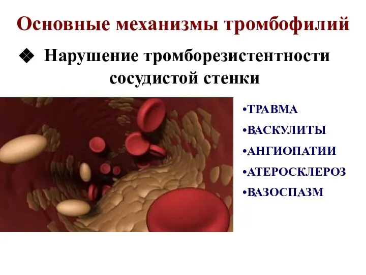 Основные механизмы тромбофилий Нарушение тромборезистентности сосудистой стенки ТРАВМА ВАСКУЛИТЫ АНГИОПАТИИ АТЕРОСКЛЕРОЗ ВАЗОСПАЗМ