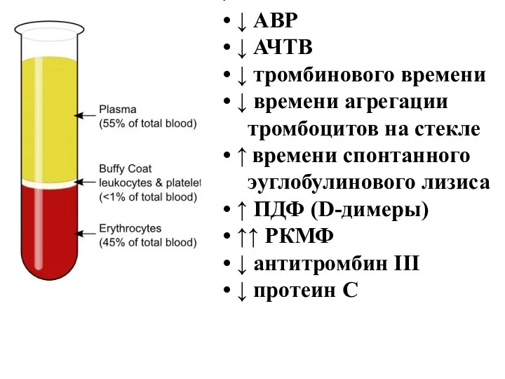 ↓ АВР ↓ АЧТВ ↓ тромбинового времени ↓ времени агрегации тромбоцитов на