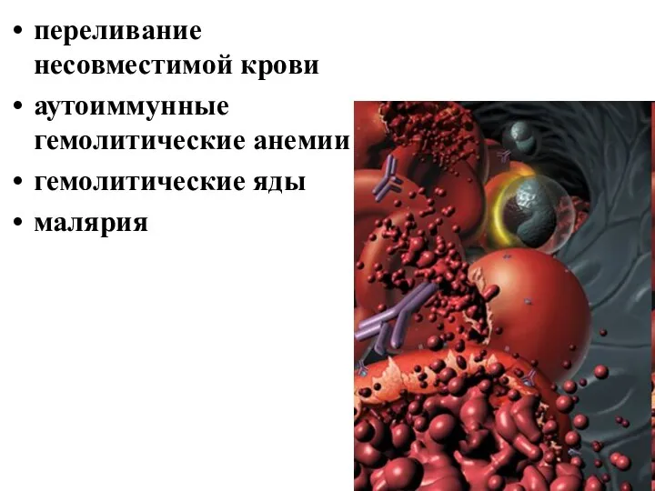 переливание несовместимой крови аутоиммунные гемолитические анемии гемолитические яды малярия