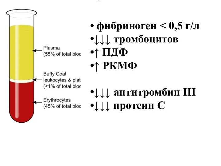 фибриноген ↓↓↓ тромбоцитов ↑ ПДФ ↑ РКМФ ↓↓↓ антитромбин III ↓↓↓ протеин C