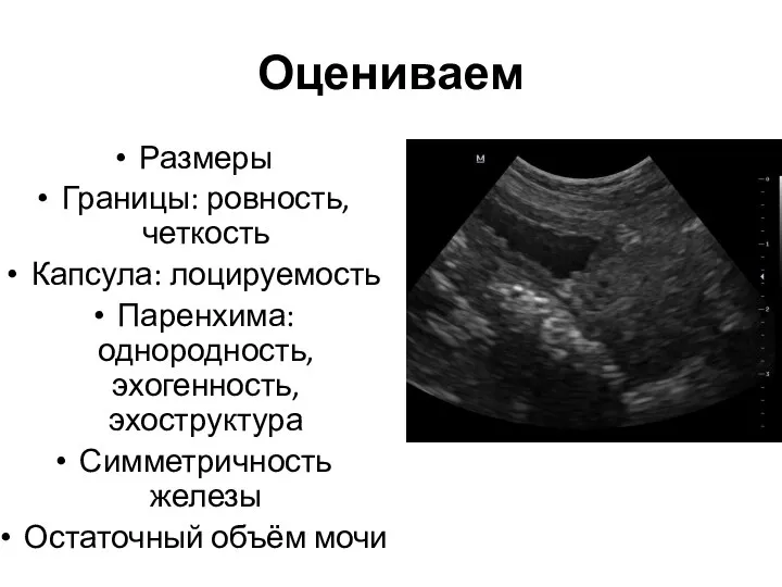 Оцениваем Размеры Границы: ровность, четкость Капсула: лоцируемость Паренхима: однородность, эхогенность, эхоструктура Симметричность железы Остаточный объём мочи