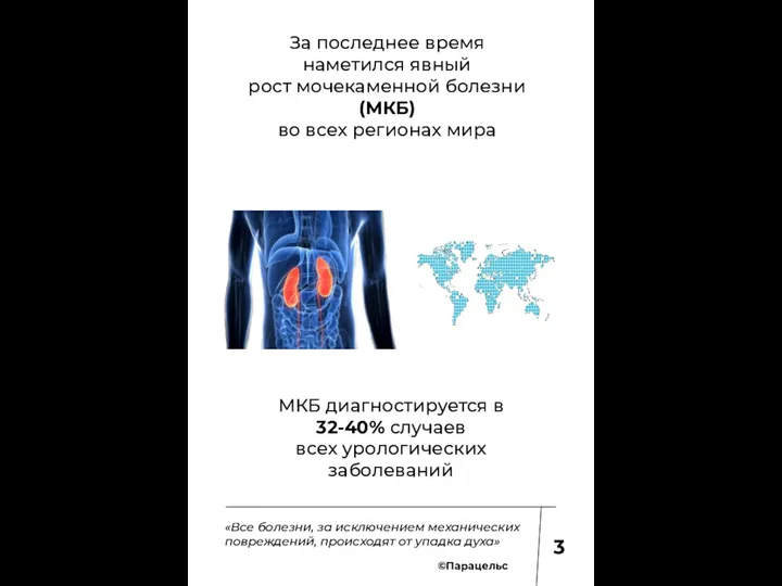 За последнее время наметился явный рост мочекаменной болезни (МКБ) во всех регионах