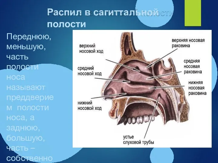 Распил в сагиттальной полости Переднюю, меньшую, часть полости носа называют преддверием полости