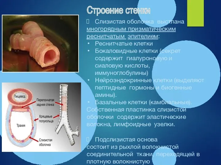 Слизистая оболочка выстлана многорядным призматическим реснитчатым эпителием: Реснитчатые клетки Бокаловидные клетки (секрет