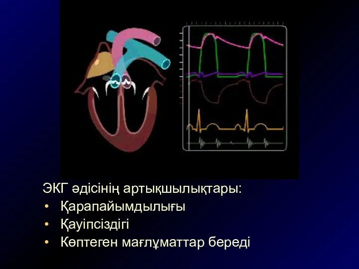 ЭКГ әдісінің артықшылықтары: Қарапайымдылығы Қауіпсіздігі Көптеген мағлұматтар береді