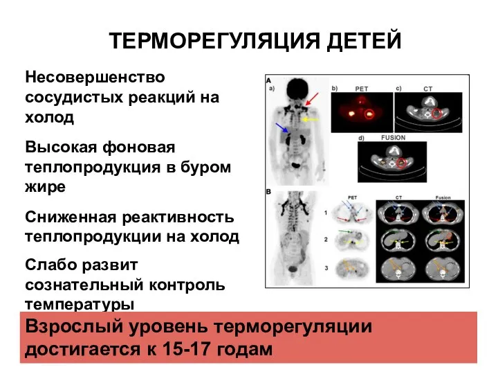 ТЕРМОРЕГУЛЯЦИЯ ДЕТЕЙ Несовершенство сосудистых реакций на холод Высокая фоновая теплопродукция в буром