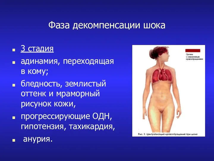 Фаза декомпенсации шока 3 стадия адинамия, переходящая в кому; бледность, землистый оттенк