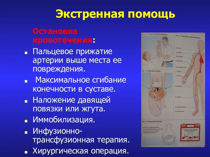 Экстренная помощь Остановка кровотечения: Пальцевое прижатие артерии выше места ее повреждения. Максимальное