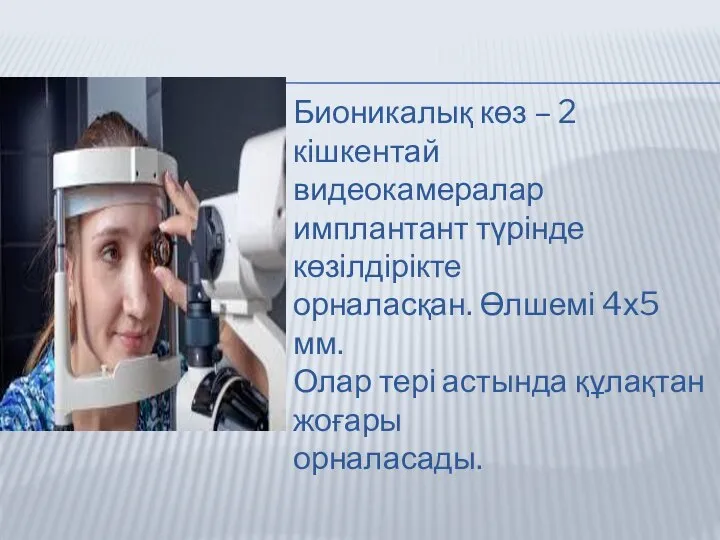 Бионикалық көз – 2 кішкентай видеокамералар имплантант түрінде көзілдірікте орналасқан. Өлшемі 4х5