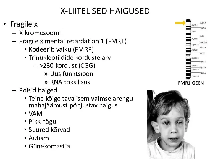 X-LIITELISED HAIGUSED Fragile x X kromosoomil Fragile x mental retardation 1 (FMR1)