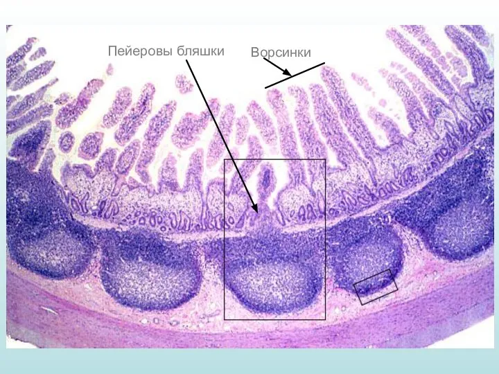 Пейеровы бляшки Ворсинки