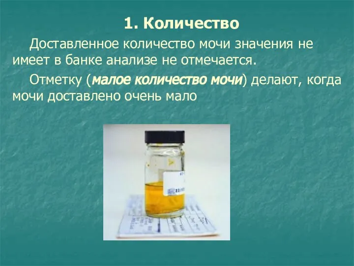 1. Количество Доставленное количество мочи значения не имеет в банке анализе не