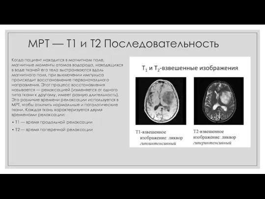МРТ — Т1 и Т2 Последовательность Когда пациент находится в магнитном поле,