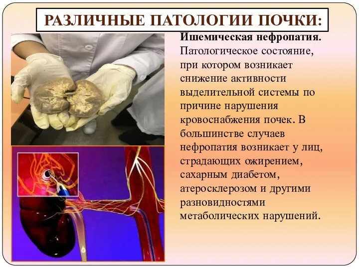 РАЗЛИЧНЫЕ ПАТОЛОГИИ ПОЧКИ: Ишемическая нефропатия. Патологическое состояние, при котором возникает снижение активности