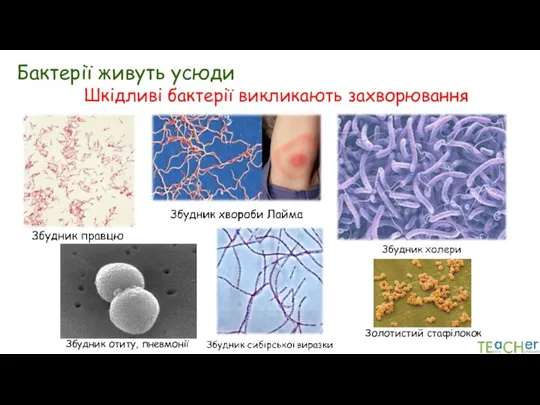 Бактерії живуть усюди Шкідливі бактерії викликають захворювання