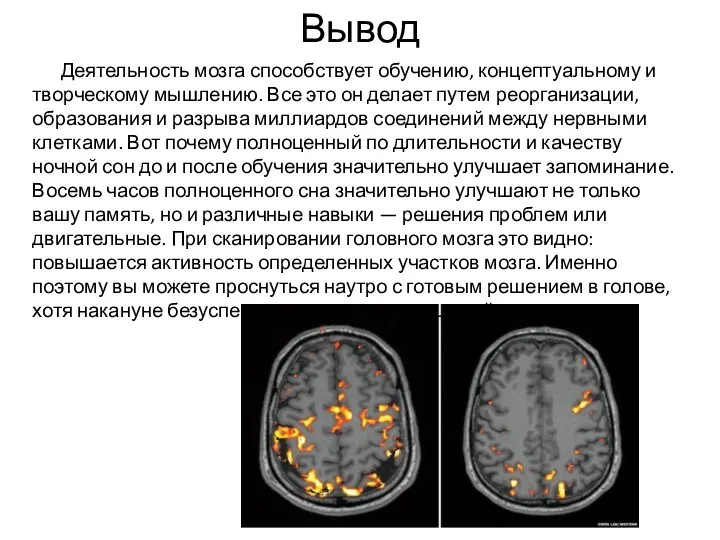 Вывод Деятельность мозга способствует обучению, концептуальному и творческому мышлению. Все это он