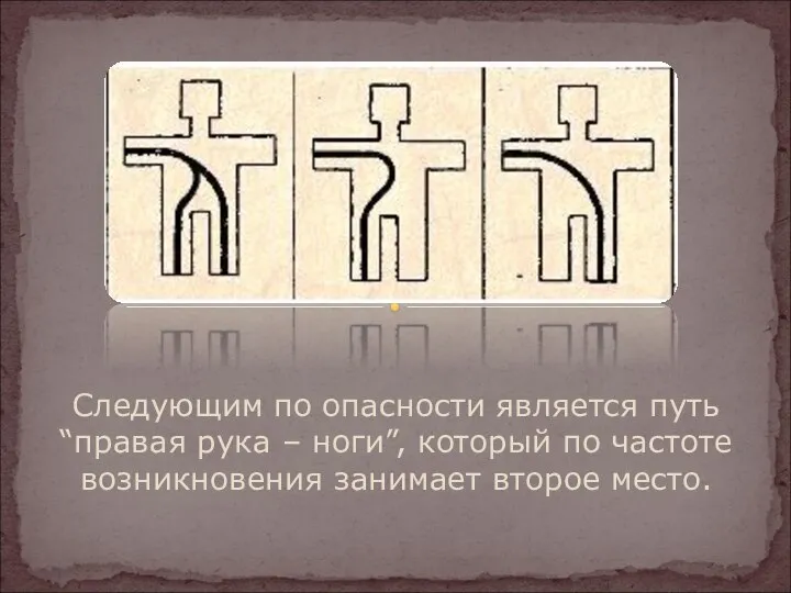 Следующим по опасности является путь “правая рука – ноги”, который по частоте возникновения занимает второе место.