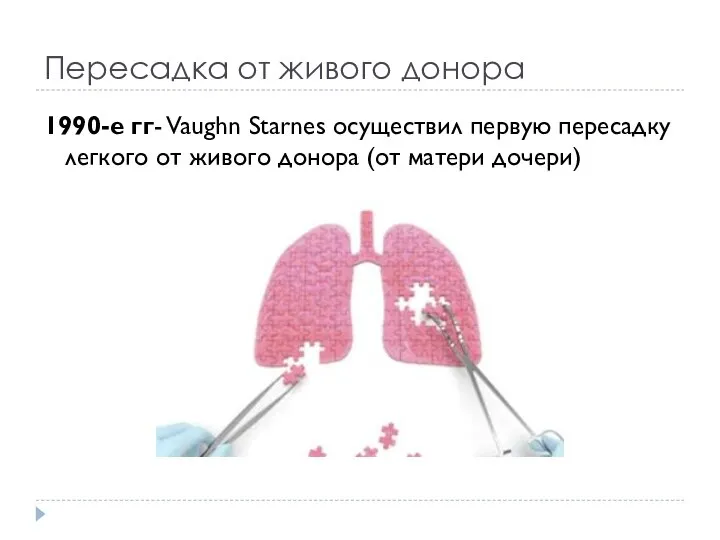 Пересадка от живого донора 1990-е гг- Vaughn Starnes осуществил первую пересадку легкого