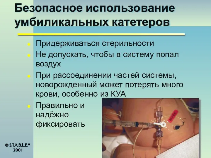 Безопасное использование умбиликальных катетеров Придерживаться стерильности Не допускать, чтобы в систему попал