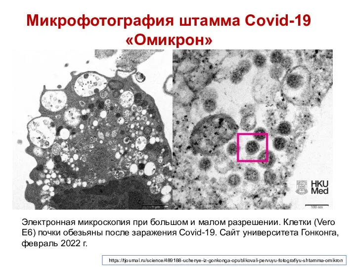 Микрофотография штамма Covid-19 «Омикрон» Электронная микроскопия при большом и малом разрешении. Клетки