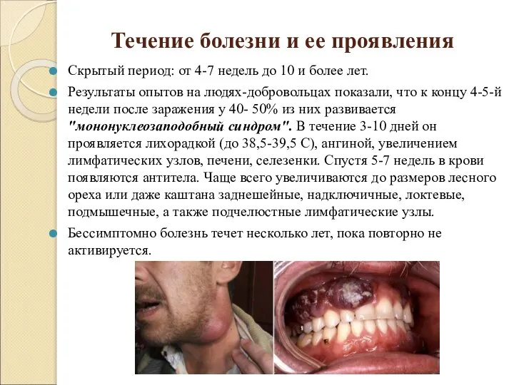 Течение болезни и ее проявления Скрытый период: от 4-7 недель до 10