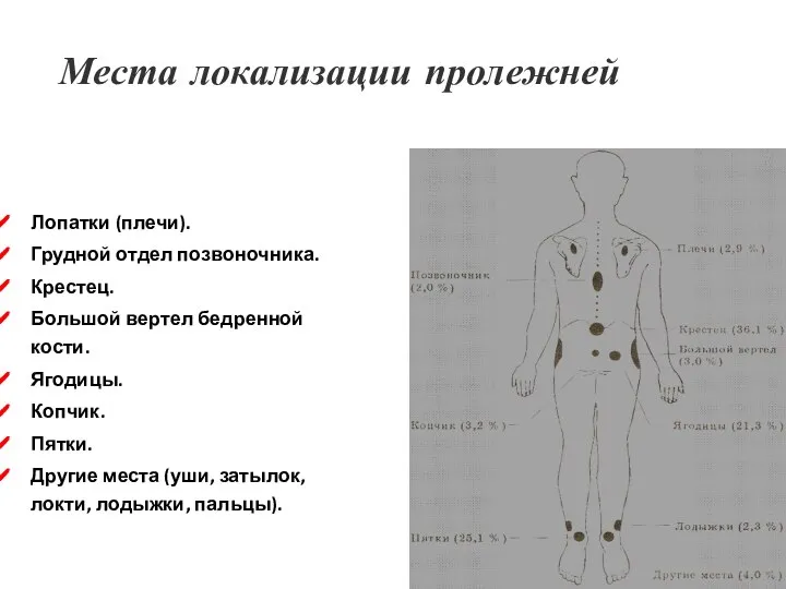 Места локализации пролежней Лопатки (плечи). Грудной отдел позвоночника. Крестец. Большой вертел бедренной