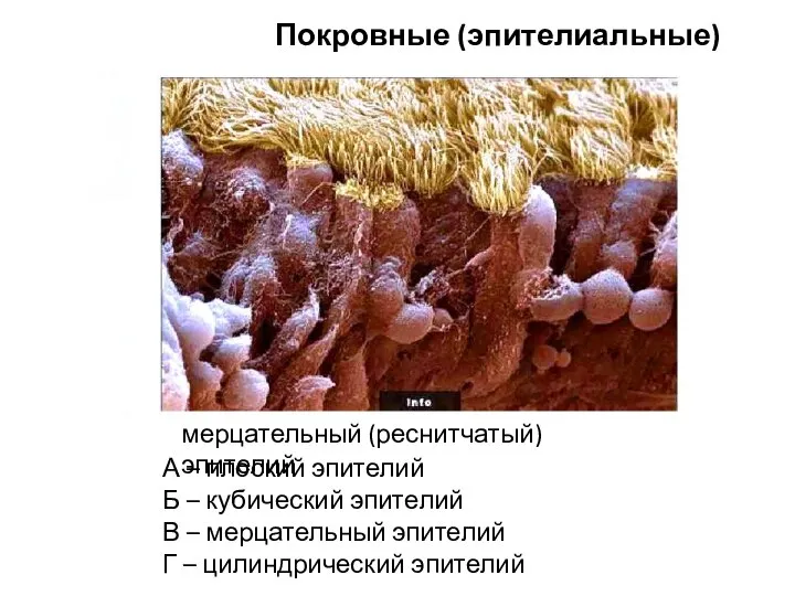 А – плоский эпителий Б – кубический эпителий В – мерцательный эпителий