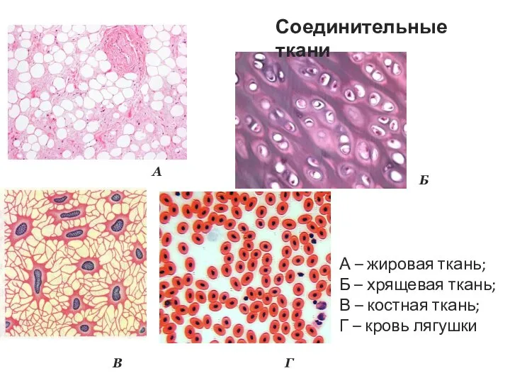 А – жировая ткань; Б – хрящевая ткань; В – костная ткань;