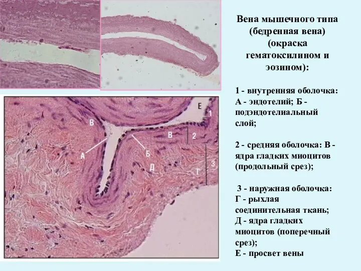 Вена мышечного типа (бедренная вена) (окраска гематоксилином и эозином): 1 - внутренняя