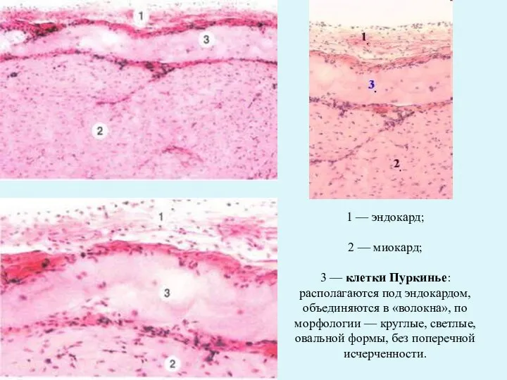 1 — эндокард; 2 — миокард; 3 — клетки Пуркинье: располагаются под