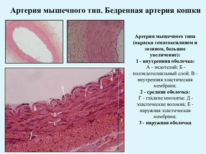 Артерия мышечного тип. Бедренная артерия кошки Артерия мышечного типа (окраска гематоксилином и